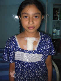 Rashida - Ventricular Septal Defect